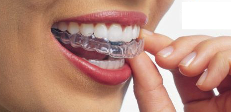 Tratamiento Invisalign