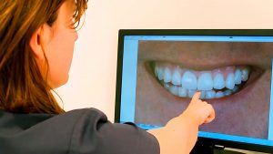 Bruxismo. Caso clínico