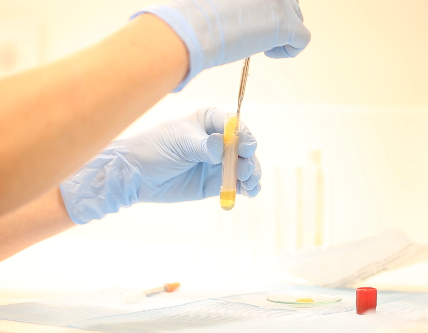 Plasma rico en factores de crecimiento