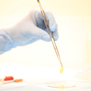 Plasma rico en factores de crecimiento