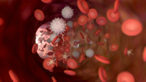 Plasma rico en factores de crecimiento