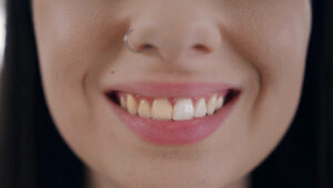 Blanqueamiento para dientes blancos