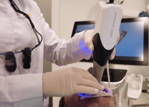 Diseño de sonrisa digital