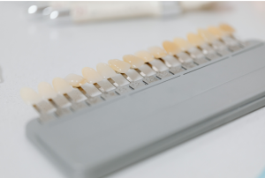 Guia tonos colores blancos dientes