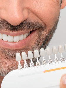 Guia tonos colores blancos dientes